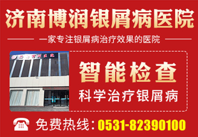 济南博润银屑病医院