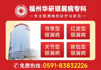 福州华研银屑病专科