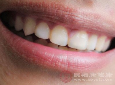 定期到口腔专科医院进行洁牙(俗称洗牙)，可去除牙齿表面的牙垢与菌斑，保持牙齿的整洁和健康