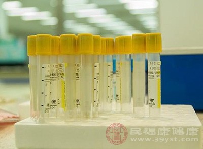 定期到医院来做身体检查，包括尿液分析、肾功能指标的检测等