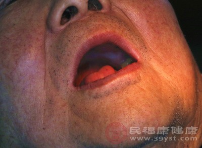 戒烟后，口腔内的唾液分泌减少，口腔干燥感明显