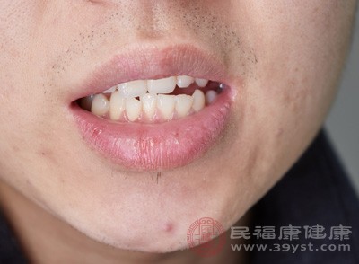 臉部腫脹的一個常見原因是牙齦膿腫，這是由牙齒周圍細菌感染引起的