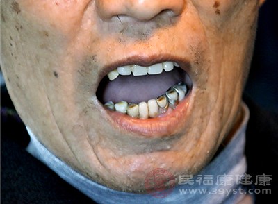 现在很多人都会定期洁牙，预防牙周疾病