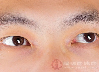 黑眼圈在很多的年轻人身上最为常见，有的人黑眼圈会比较重被人称为“熊猫眼”