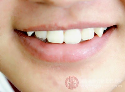牙缝中抠出的物质又黄又臭 如何做保持清新口气