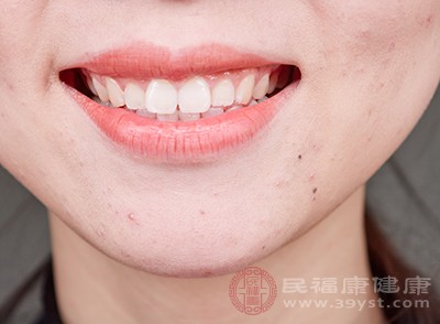 对于那些牙缝中黄色物质多的人，建议去洗牙，后期要积极的注意牙齿的保护