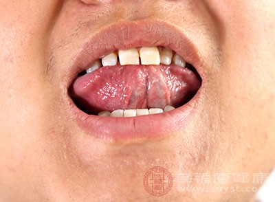 舌头下面，其实也有静脉存在，一般被称为“浅静脉”