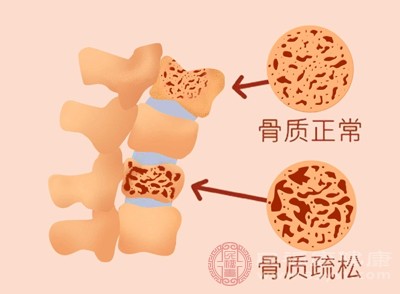 吃太多甜食，会影响到机体对于钙质的吸收和利用