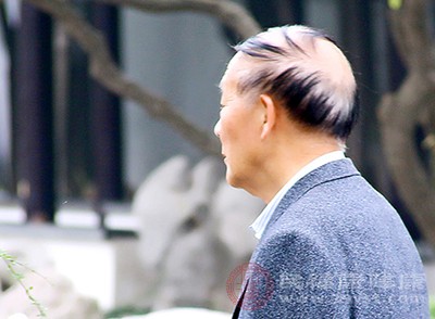 尤其是老年人，一头白发是在正常不过的事情