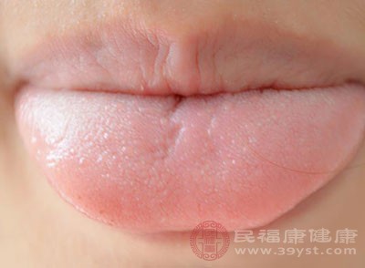 中医上面认为舌苔发白往往是表证、寒证的变现