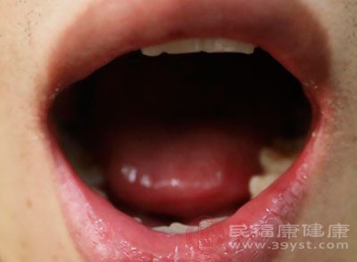 混杂着口腔中其他细菌，会在十天左右成熟