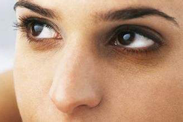 遗传性过敏症或过敏性接触皮炎,累及眼眶周围可出现黑眼圈4