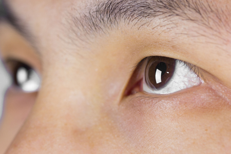 人们常说的“红眼病”指的是结膜炎 人们常说的“红眼病”指的是结膜炎