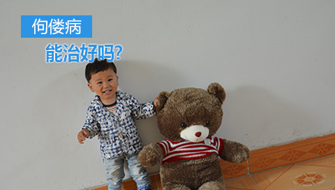 佝偻病能治好吗