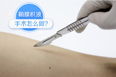 鞘膜积液手术怎么做
