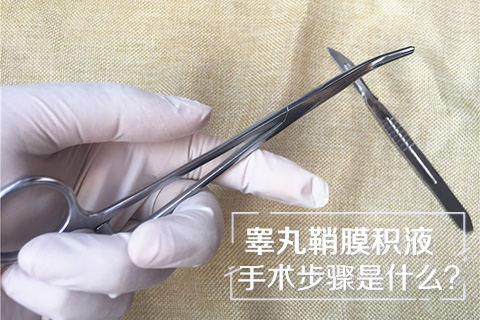 睾丸鞘膜积液手术步骤是什么