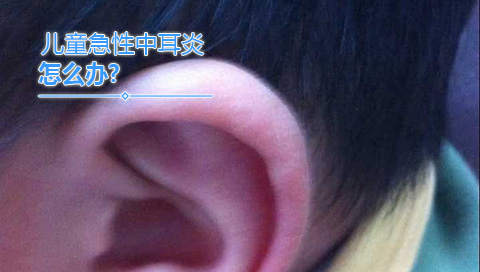 儿童急性中耳炎怎么办