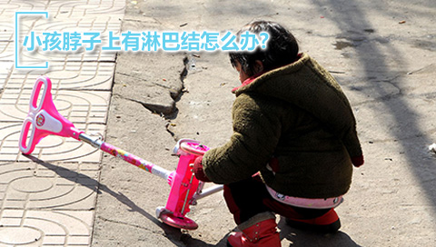 小孩脖子上有淋巴结怎么办