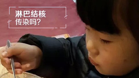 淋巴结核传染吗