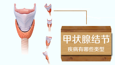 甲状腺结节疾病有哪些类型