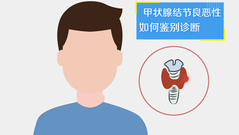 甲状腺结节良恶性如何鉴别诊断