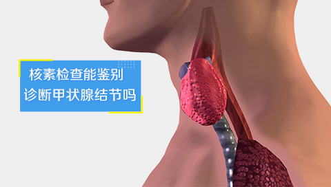 核素检查能鉴别诊断甲状腺结节吗