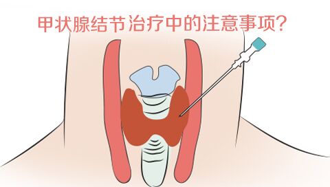甲状腺结节治疗中的注意事项