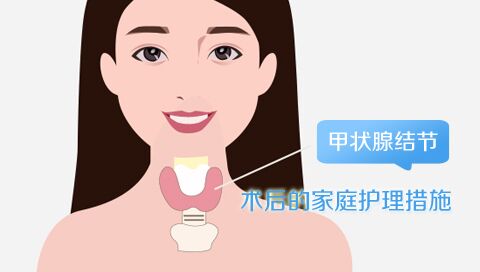 甲状腺结节术后的家庭护理措施