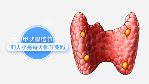 甲状腺结节的大小是每天都在变吗