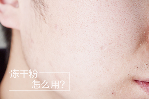 冻干粉怎么用