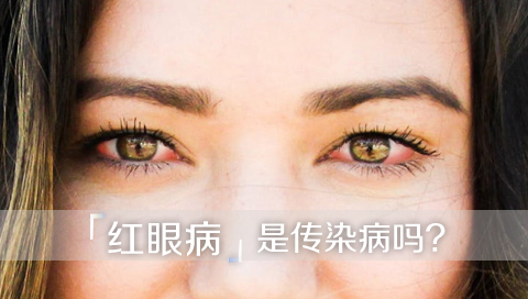红眼病是传染病吗
