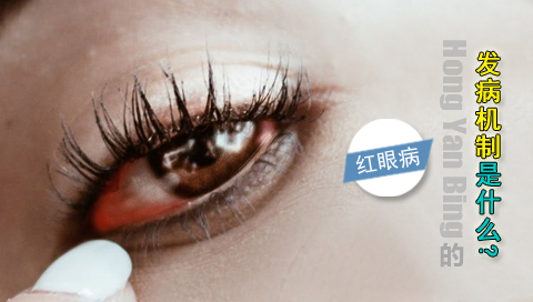 红眼病的发病机制是什么