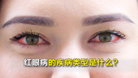 红眼病的疾病类型是什么