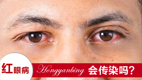 红眼病会传染吗