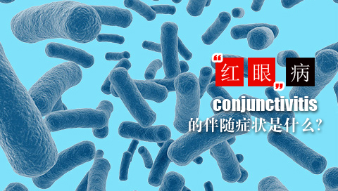 红眼病的伴随症状是什么