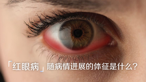 红眼病随病情进展的体征是什么