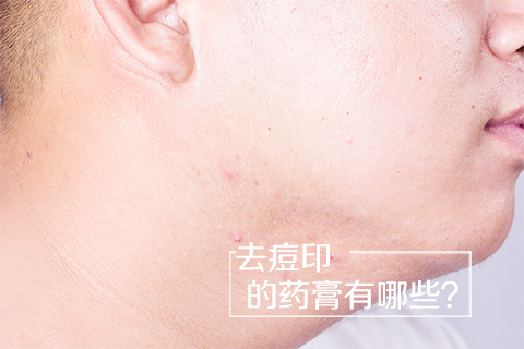 去痘印的药膏有哪些