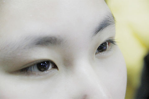 色盲就是先天性色觉障碍