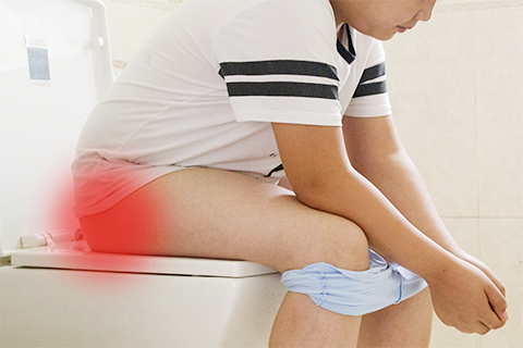 目前临床上对于痔疮的治疗主要保守治疗