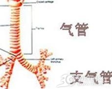 气管支气管异物