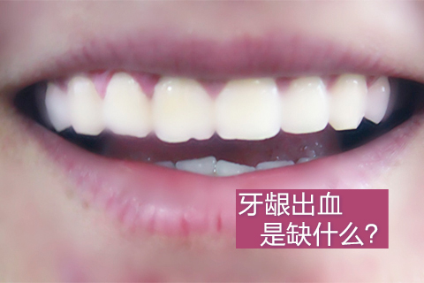 牙龈出血是缺什么