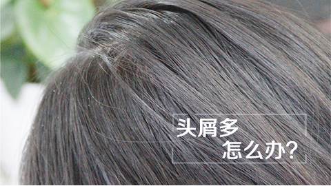 头屑多怎么办