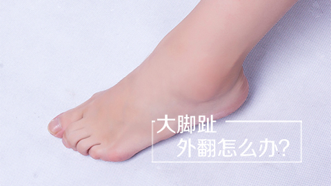 大脚趾外翻怎么办