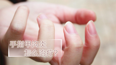 手指甲沟炎怎么治疗