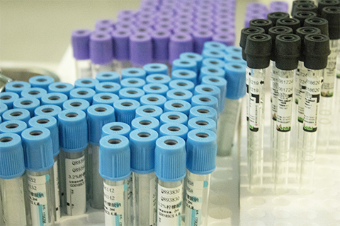 白细胞是存在于人体各个血管和组织中的免疫细胞 白细胞是存在于人体各个血管和组织中的免疫细胞