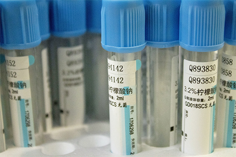 嗜酸性粒细胞是免疫反应和过敏反应中比较重要的一种细胞