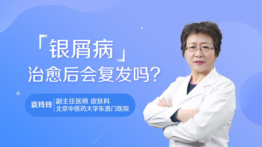 银屑病治愈后会复发吗