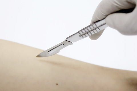 做手术对身体伤害很大