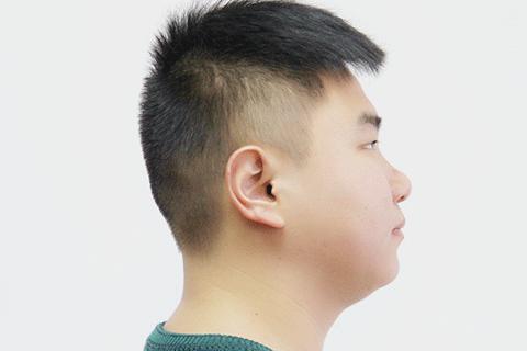 时常熬夜，晚睡，大量的喝酒，会给毛发的生长带来一定的负面影响