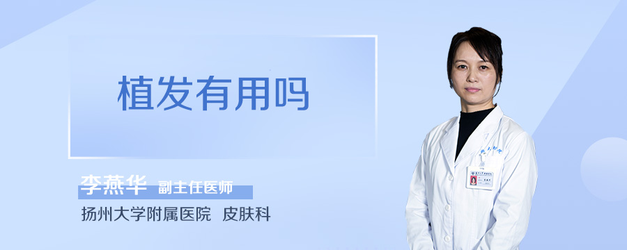 植发有用吗